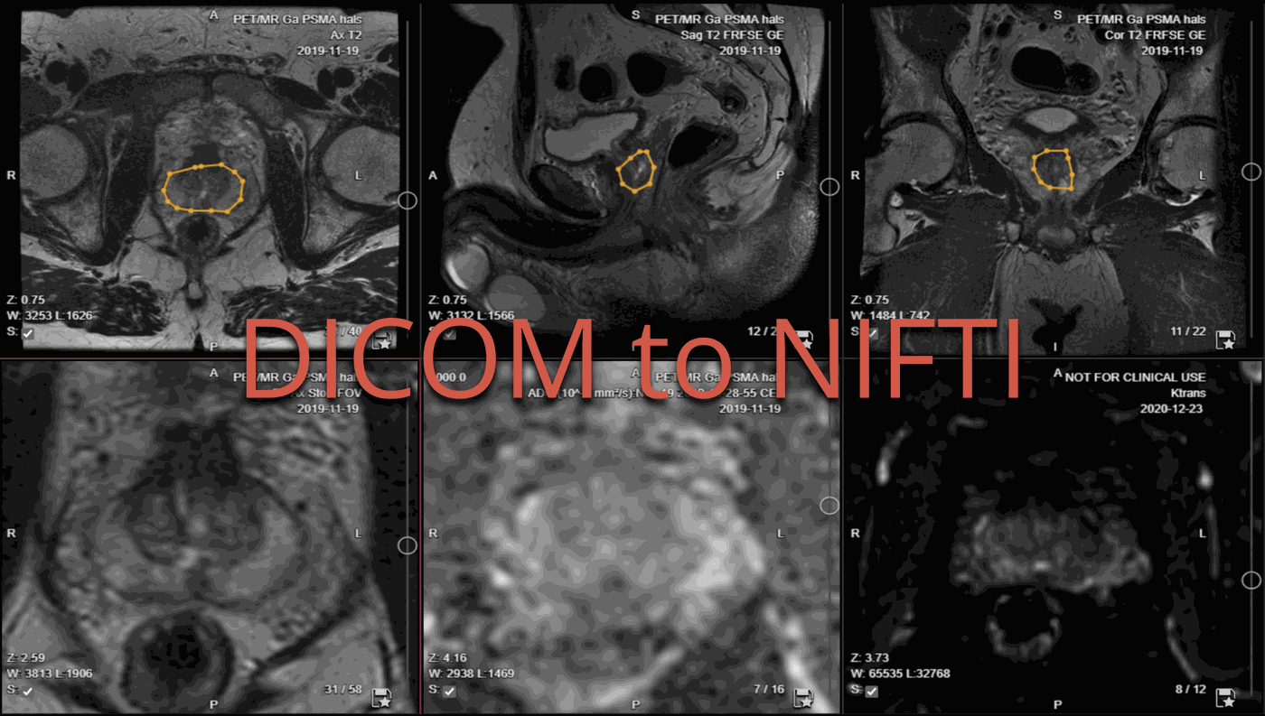 DICOM to NIfTI Conversion | Top Tools &amp; Methods